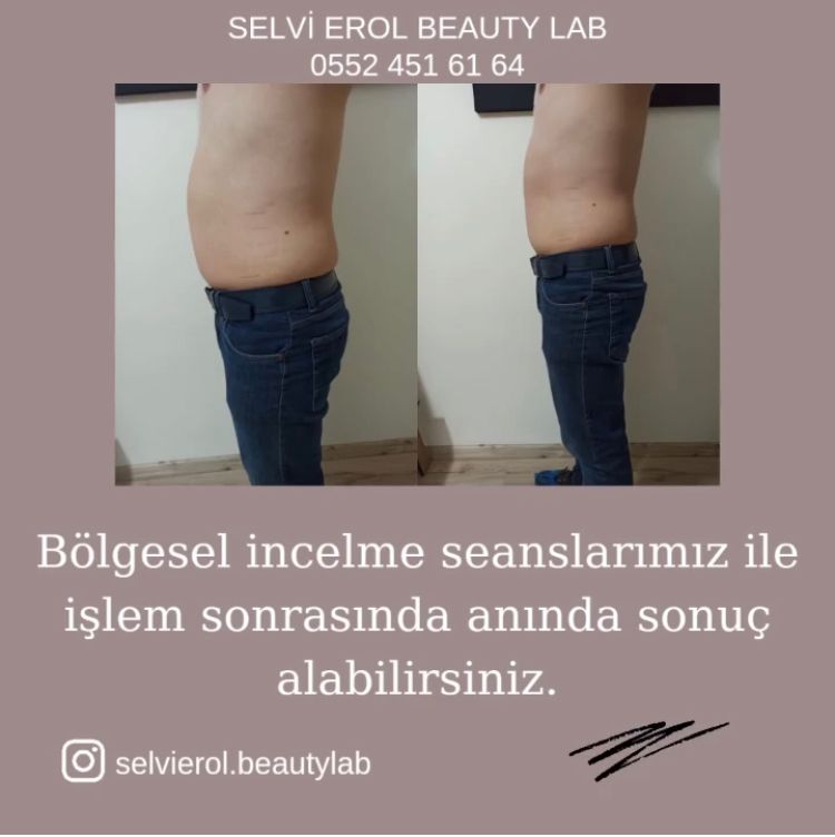 30 dakikada 2 ile 10 cm incelme