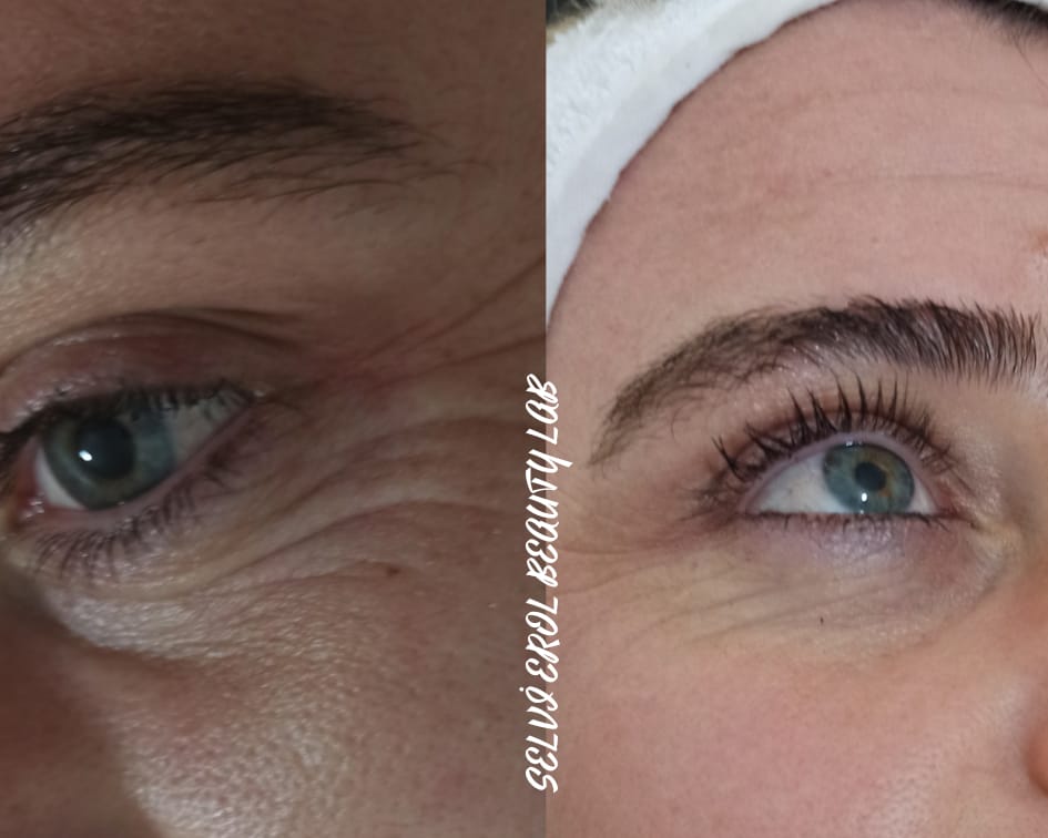 İSKENDERUN&#8217;A İYİ GELECEK VIP HİZMETLER SİZLERLE BULUŞUYOR