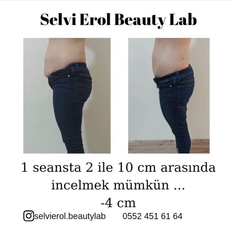 30 dakikada 2 ile 10 cm incelme