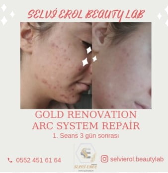 İSKENDERUN’A İYİ GELECEK VIP HİZMETLER SİZLERLE BULUŞUYOR