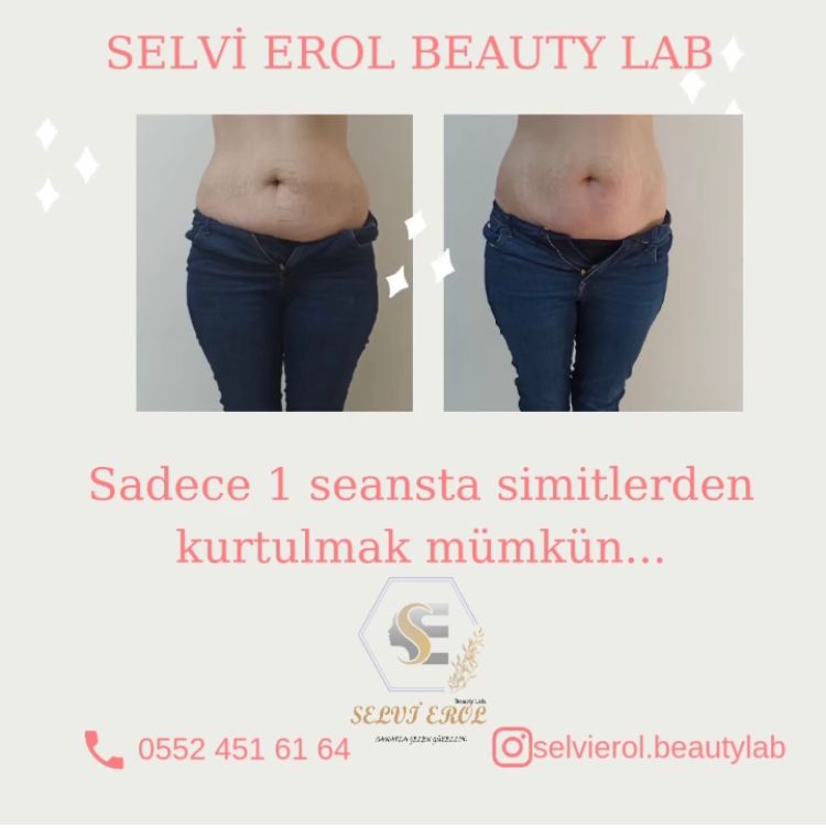 30 dakikada 2 ile 10 cm incelme