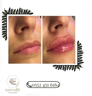 İSKENDERUN’A İYİ GELECEK VIP HİZMETLER SİZLERLE BULUŞUYOR