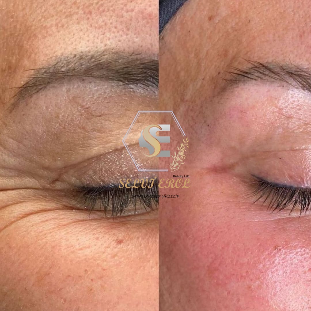 İSKENDERUN’A İYİ GELECEK VIP HİZMETLER SİZLERLE BULUŞUYOR