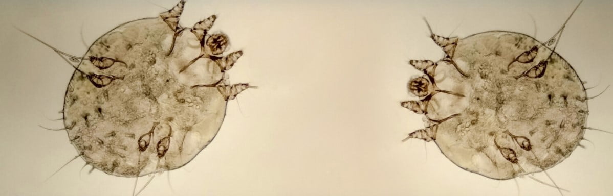 UYUZ HASTALIĞI NEDİR? NASIL TEDAVİ EDİLİR?