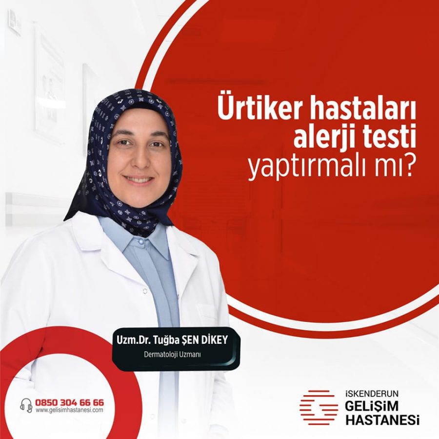 Ürtiker hastaları alerji testi yaptırmalı mı?