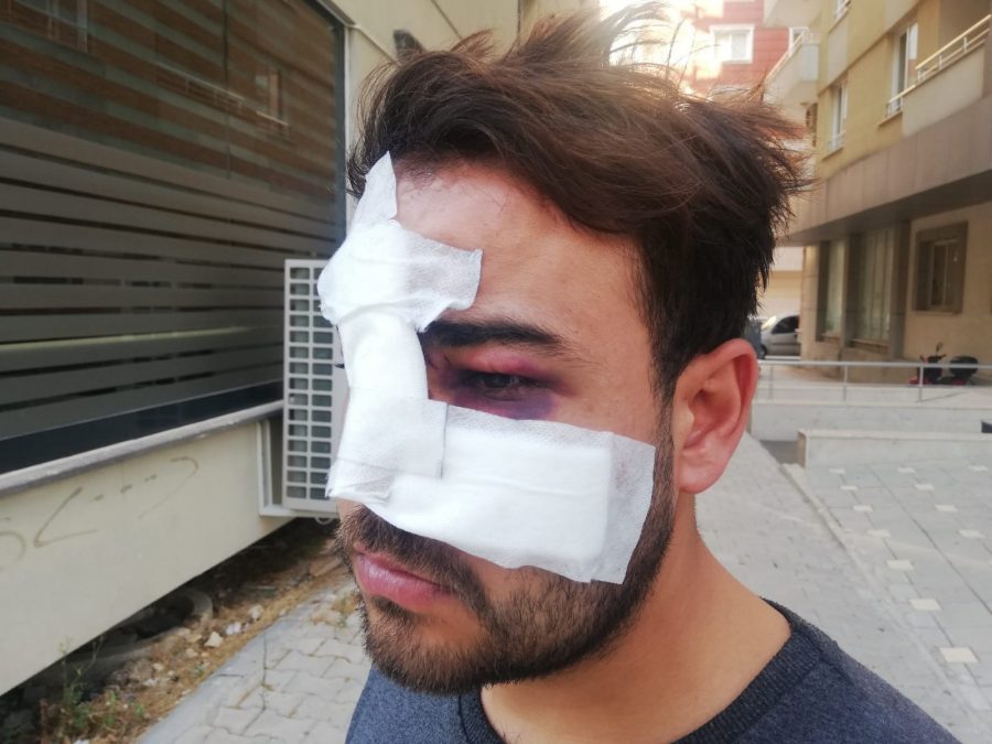 Hatay&rsquo;da istek şarkıyı bilmeyen m&uuml;zisyenin y&uuml;z&uuml;nde şişe kırdılar