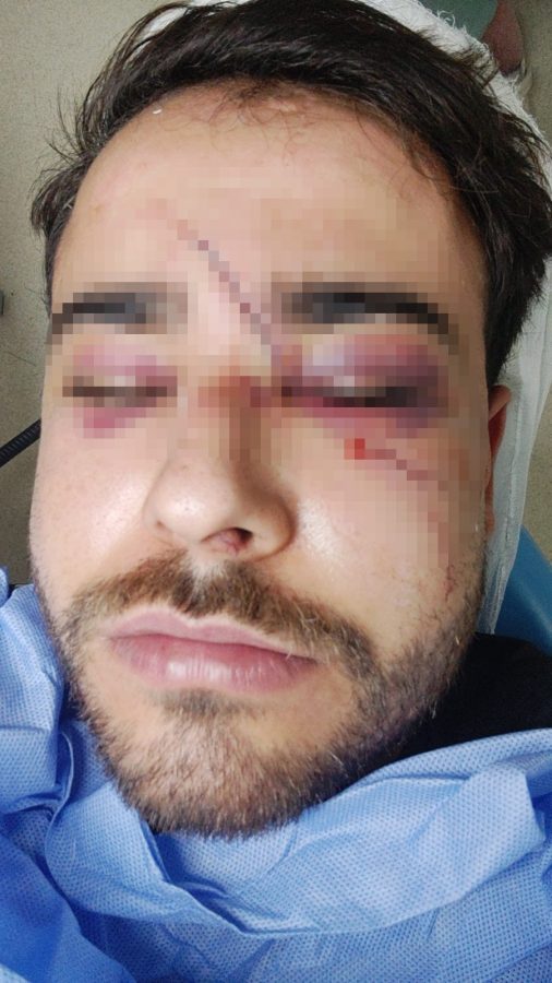 Hatay&rsquo;da istek şarkıyı bilmeyen m&uuml;zisyenin y&uuml;z&uuml;nde şişe kırdılar