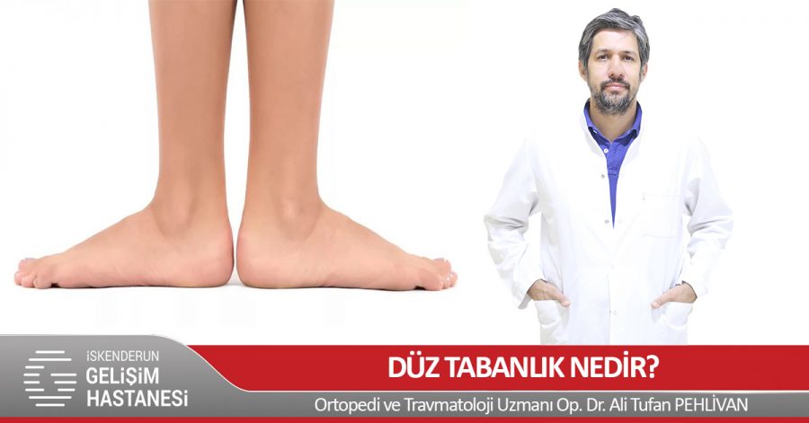 DÜZ TABANLIK NEDİR?