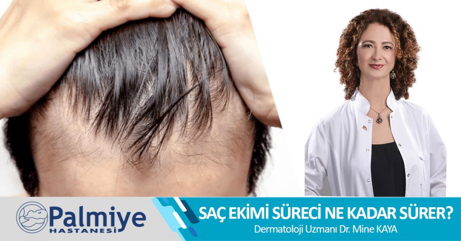 SAÇ EKİMİ SÜRECİ NE KADAR SÜRER?