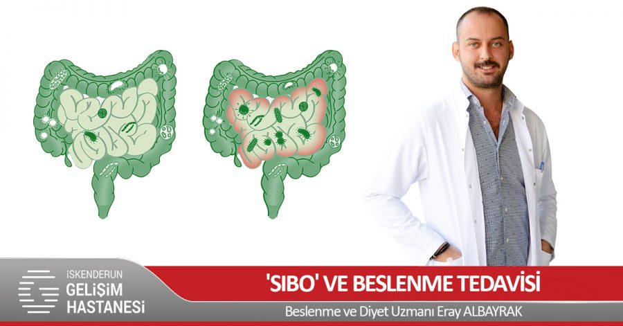 &#8216;SIBO&#8217; VE BESLENME TEDAVİSİ